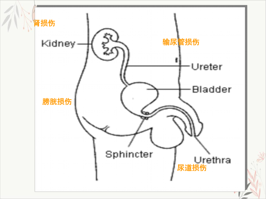 泌尿外科护理讲课课件.pptx_第2页