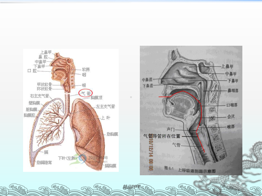 气管切开后患者的护理措施和注意事项课件.ppt_第3页