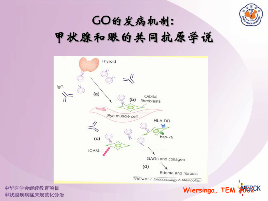 甲状腺相关眼病的治疗要点课件.ppt_第3页