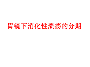 消化性溃疡的分期课件-.ppt