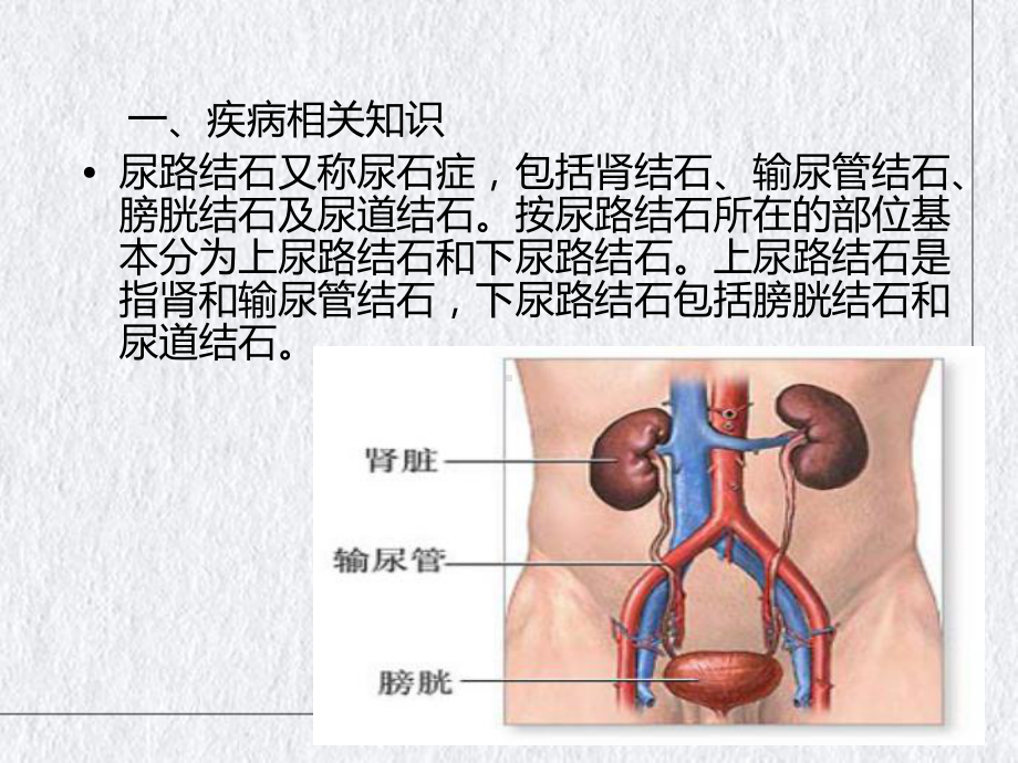 泌尿系结石健康教育优质讲课课件.ppt_第2页