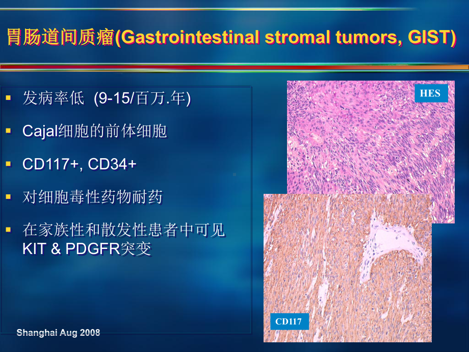 最新GIST治疗最新进展：伊马替尼治疗失败后的治疗策略课件.ppt_第2页