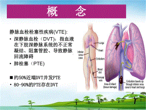 深静脉血栓治疗护理剖析讲课课件.pptx