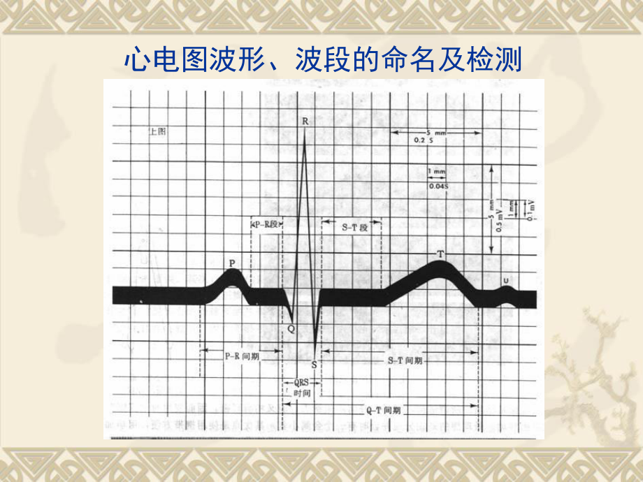 快速分析心电图详解课件.ppt_第3页