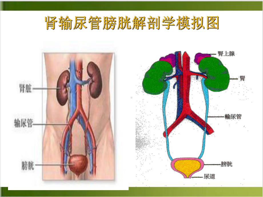 泌尿外科疾病知识及观察护理要点课件.pptx_第3页