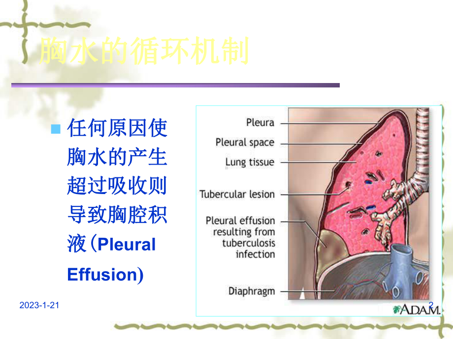 少量胸腔积液课件.ppt_第2页