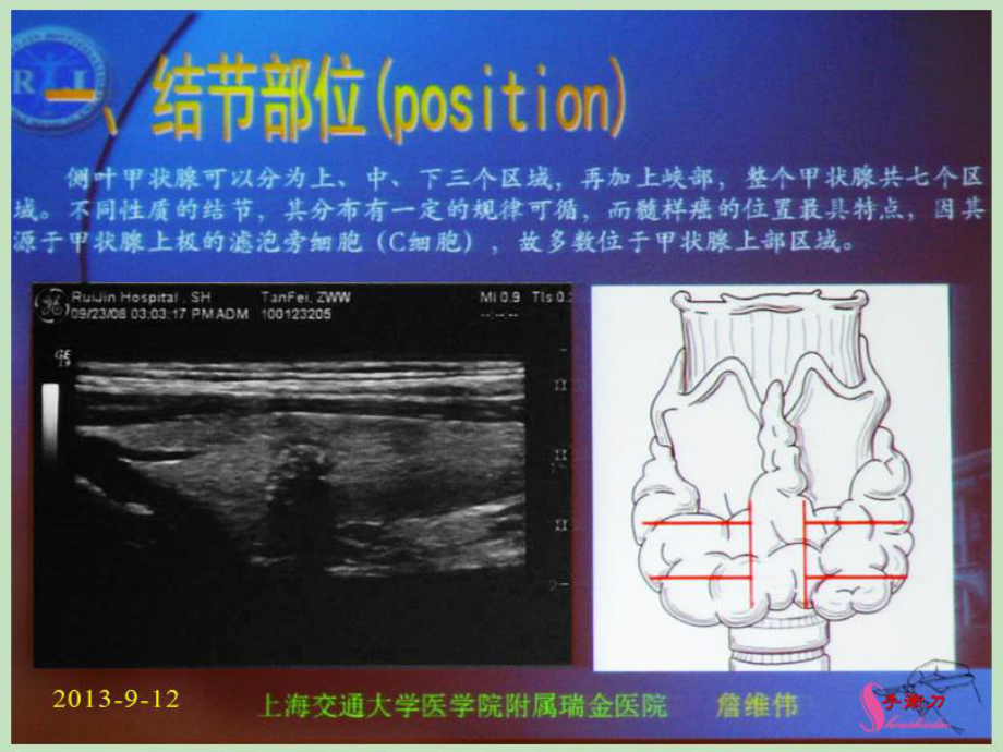 甲状腺结节超声规范及其进展课件.pptx_第1页