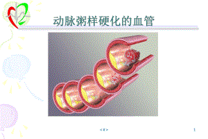 家族性纯合子型高胆固醇血症或动物模型由于巨噬细胞表面的LDL课件.ppt