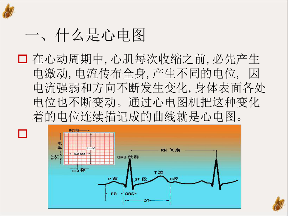 导联心电图检查精教材课件.ppt_第2页