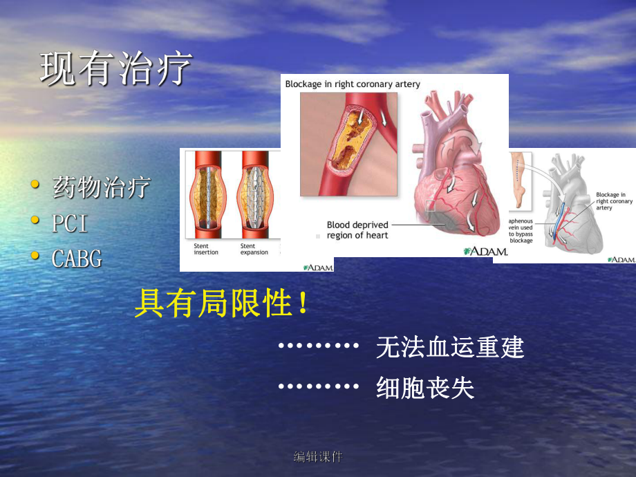 缺血性心脏病的基因治疗课件.ppt_第2页