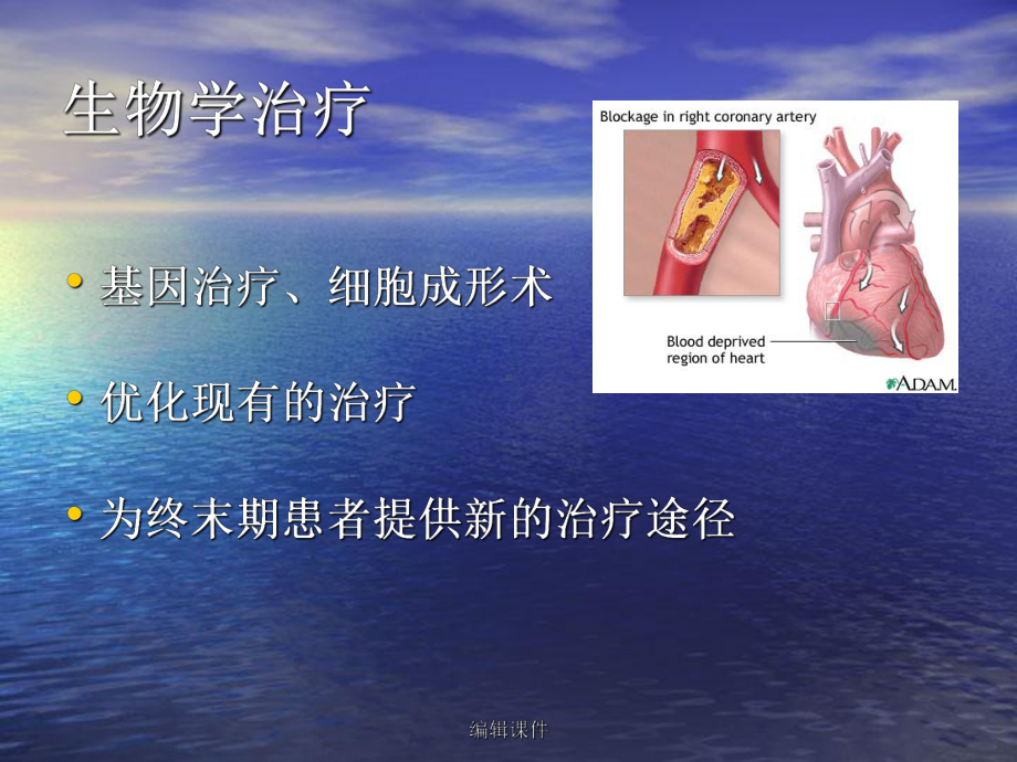 缺血性心脏病的基因治疗课件.ppt_第3页