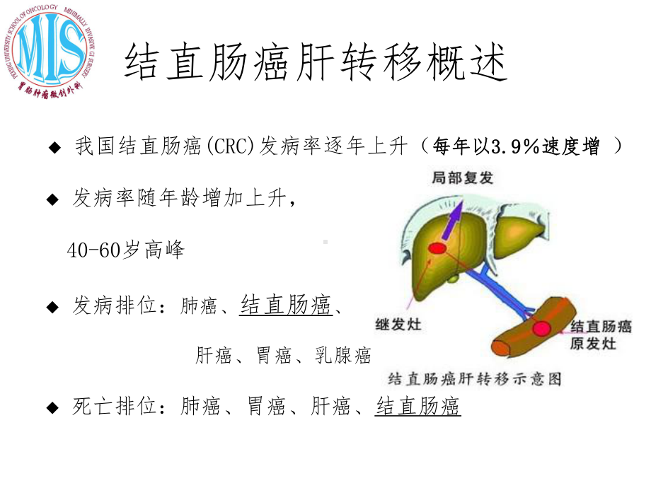 结直肠癌肝转移消融(同名1258)课件.ppt_第3页