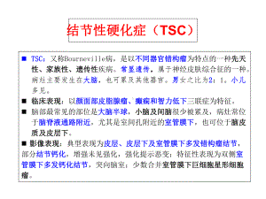 结节性硬化症-课件.ppt