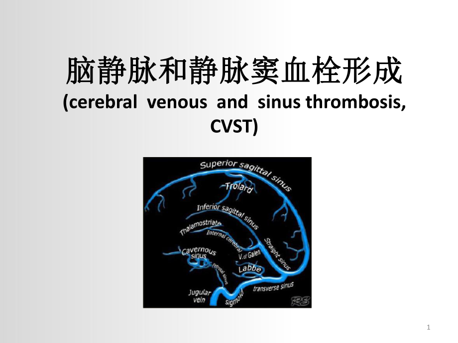 脑静脉和静脉窦血栓形成课件.ppt_第1页