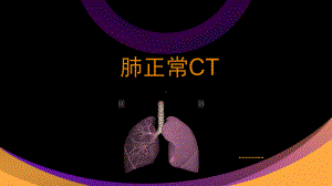 肺部正常CT解剖课件.pptx