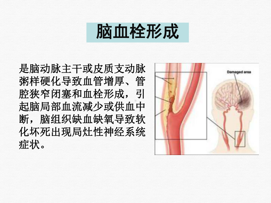 神经病学脑血管病授课课件.pptx_第1页