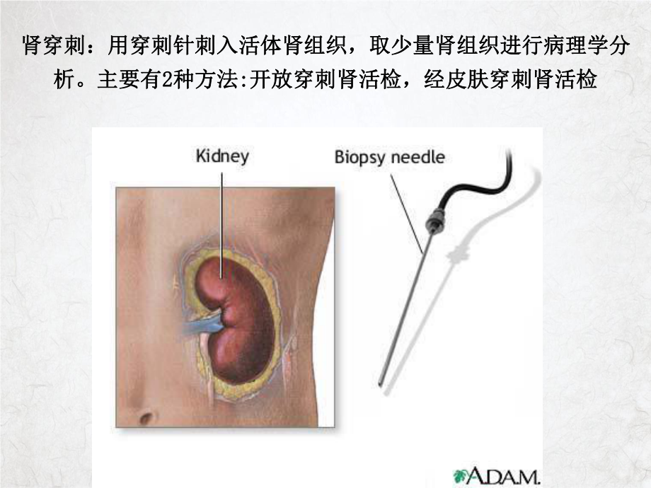 肾穿刺活检最新授课课件.ppt_第2页