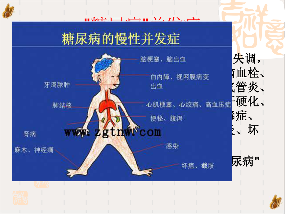 社区康复糖尿病课件.pptx_第1页