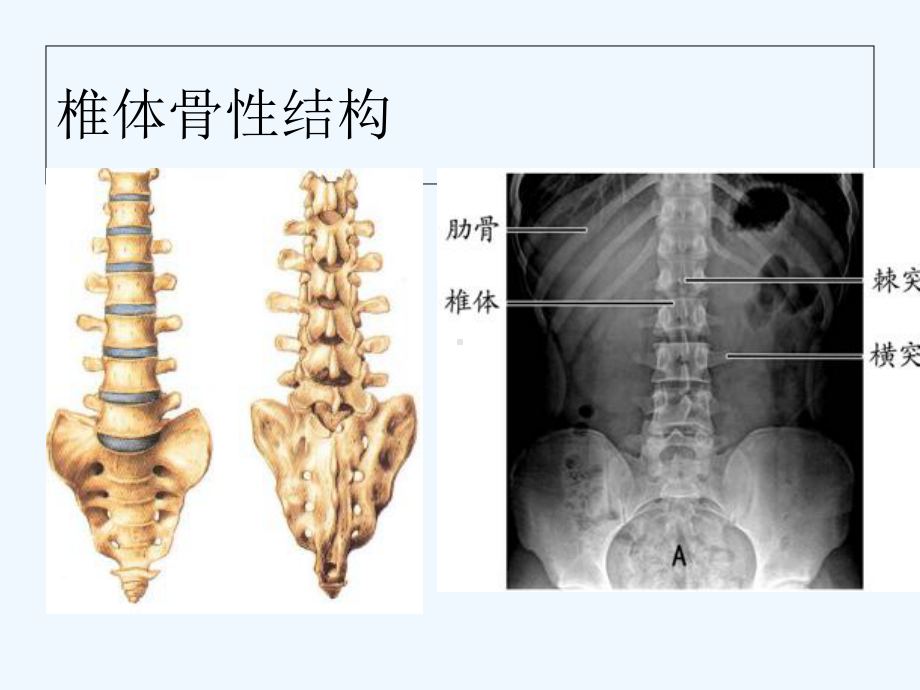 腰椎血管神经解剖1-课件.ppt_第2页