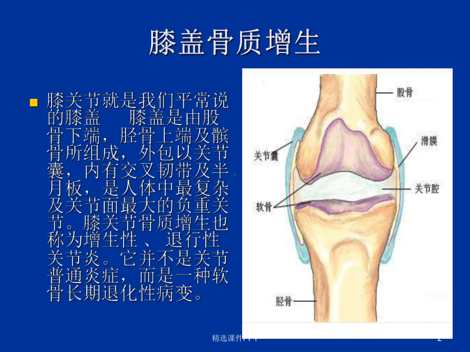 膝骨关节炎的预防和治疗改正确--0926课件.ppt_第2页