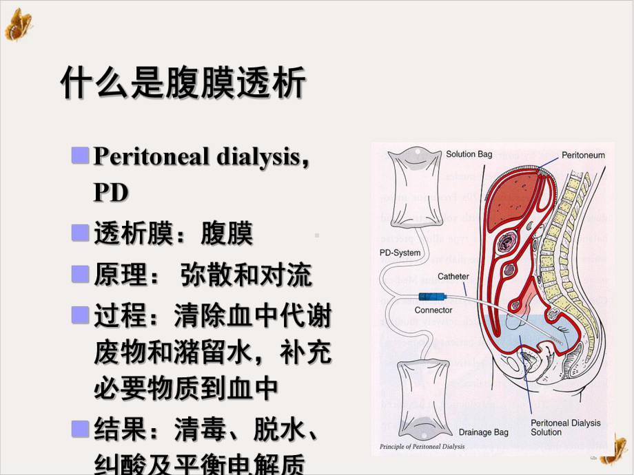 腹膜透析的原理和应用实用课件.ppt_第2页