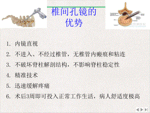 经皮介入椎间孔镜下椎间盘髓核切除术课件完整版.pptx