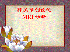 膝关节创伤的MRI-诊断课件.pptx