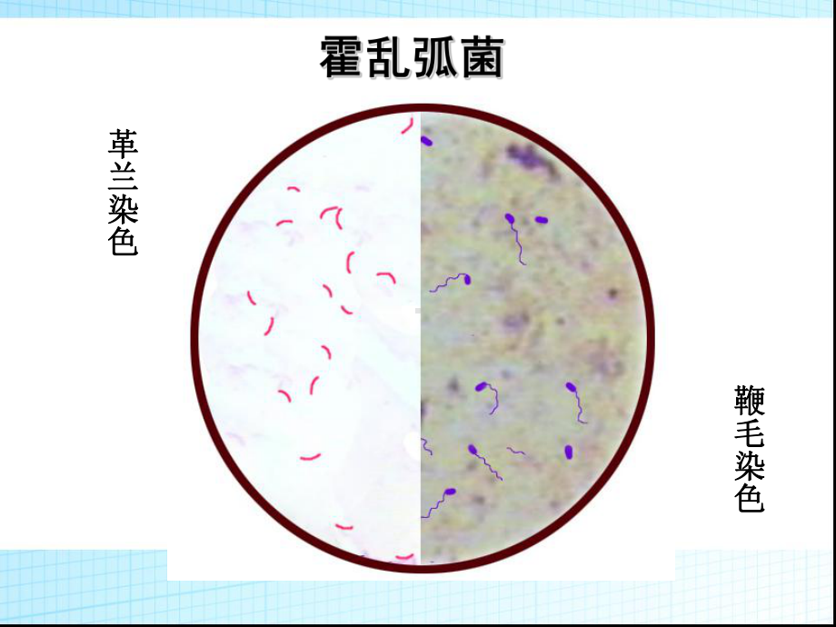 电解质紊乱急性肾功能衰竭课件.ppt_第3页