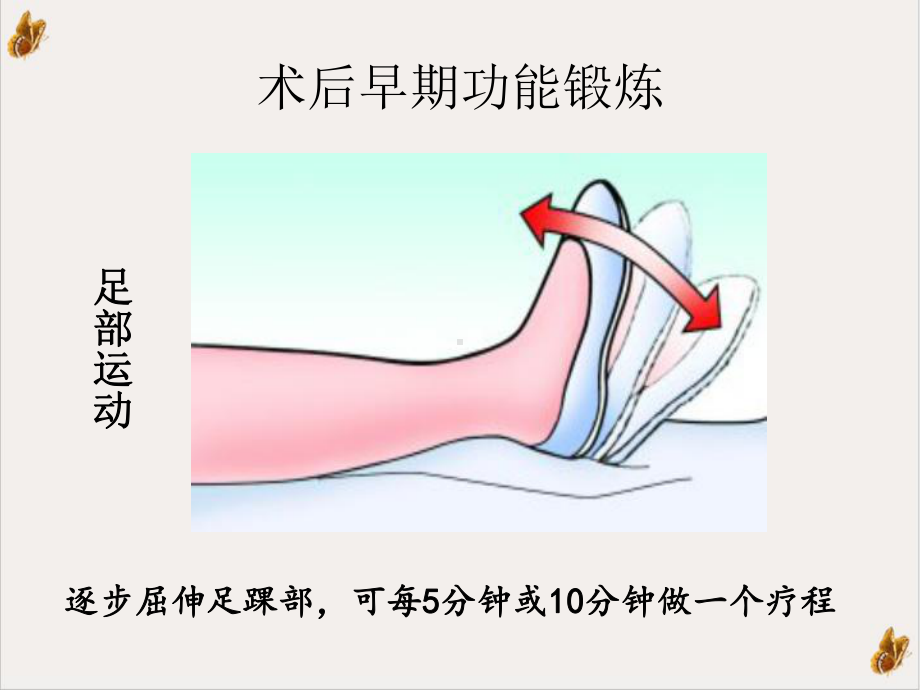 股骨颈骨折术后功能锻炼方法优质案例课件.ppt_第3页