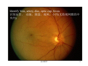 眼科常见结构及英文(行业相关)课件.ppt