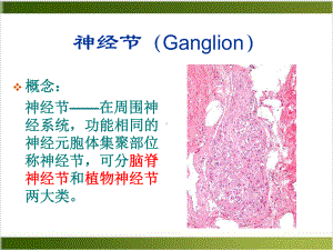 神经节来源肿瘤课件.pptx