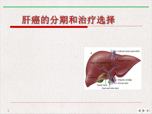 肝细胞癌的分期和治疗选择研究生实用版课件.pptx