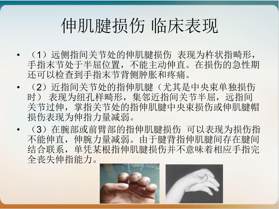 肌腱损伤与肌腱粘连护理培训课件.ppt_第3页