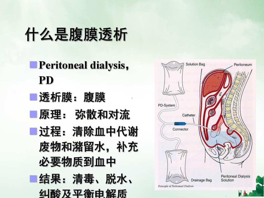 腹膜透析的原理和应用课件.ppt_第3页