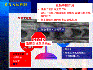 肾功能不全伴糖尿病患者CT检查课件.pptx