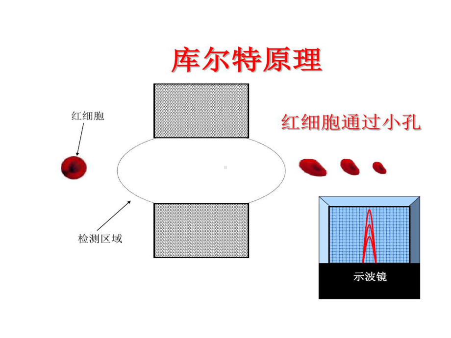 血细胞直方图和散点图临床意义课件.ppt_第3页