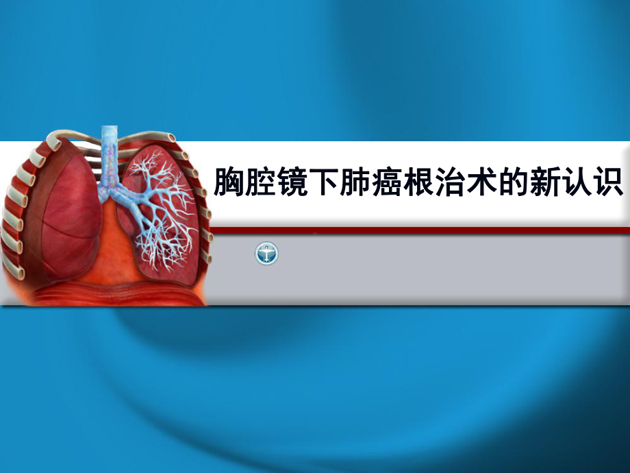 胸腔镜下肺癌根治术的新认识课件.ppt_第1页