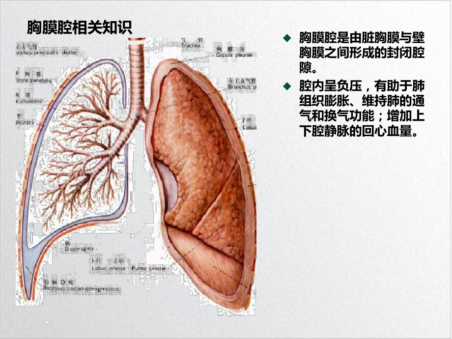 肺大疱及胸腔镜相关知识课件.ppt_第3页