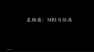 直肠癌：MRI与临床课件.pptx