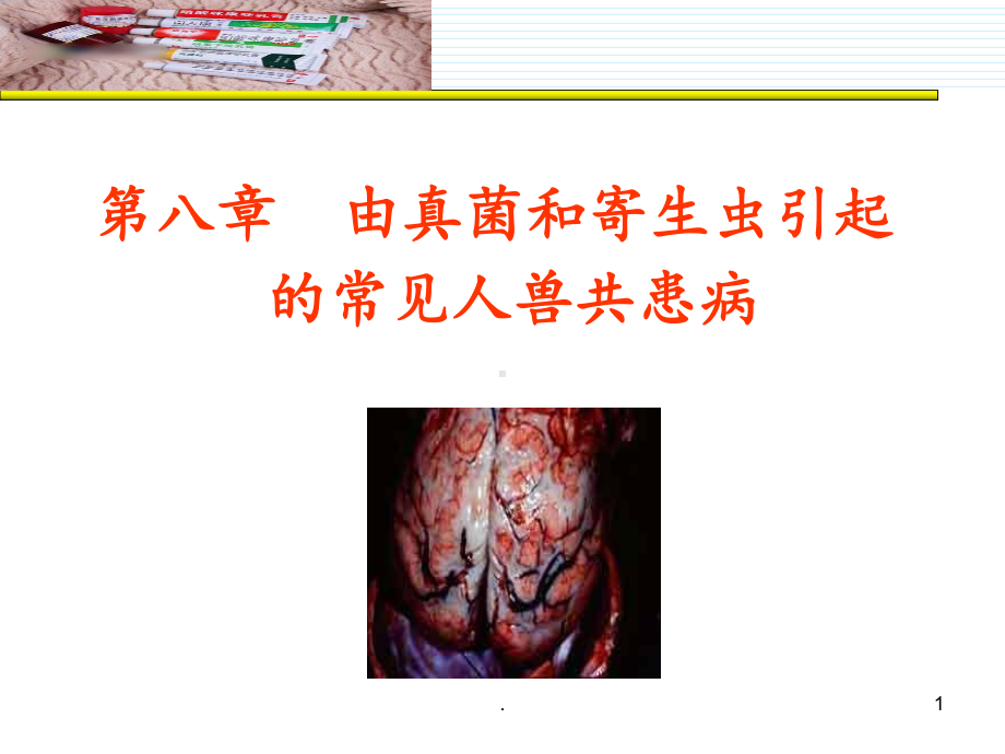 第八章由真菌和寄生虫引起的常见人兽共患病课件.ppt_第1页