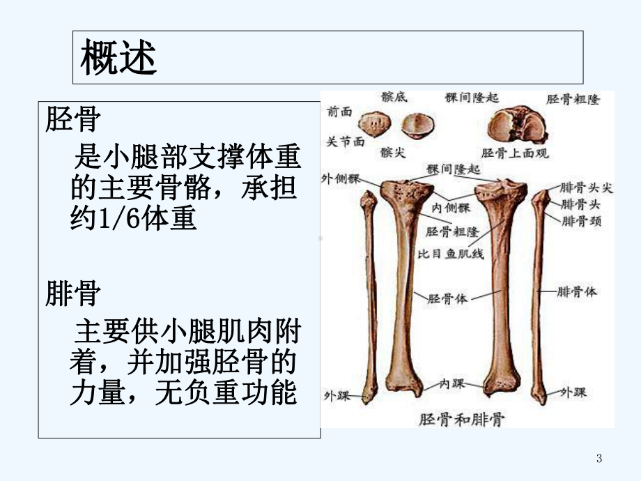 胫腓骨骨折手术配合及访视-课件.ppt_第3页