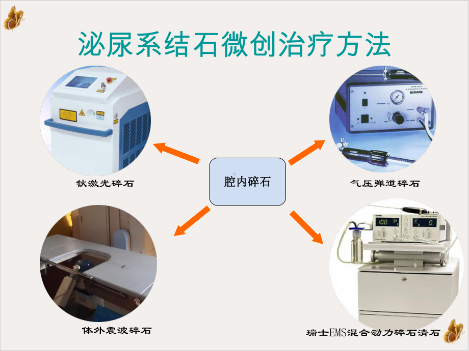 简析泌尿系结石微创治疗课件.pptx_第3页