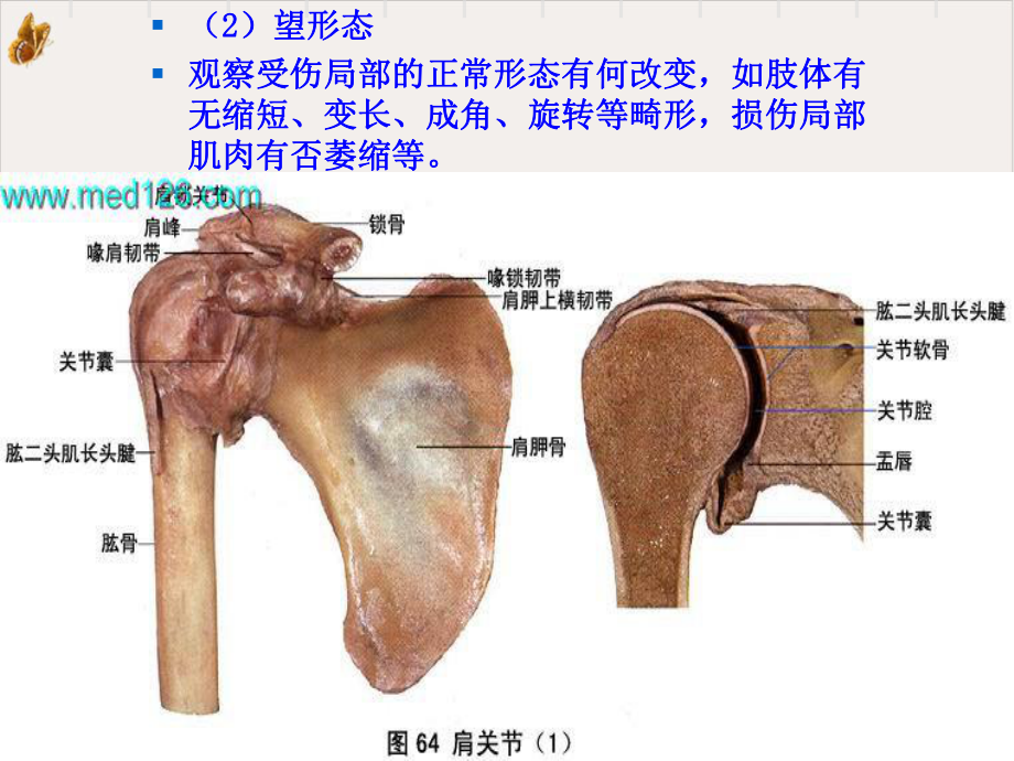 第二章运动损伤的检查与诊断课件整理.ppt_第3页