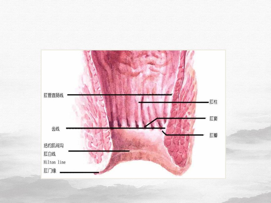 直肠肛管疾病患者的护理课件.pptx_第3页