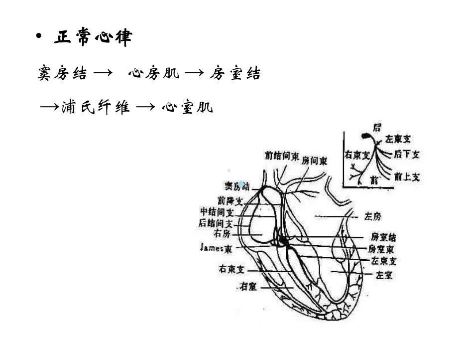 第23章抗心律失常药课件.ppt_第2页