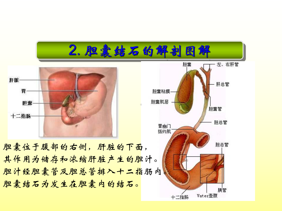 腹腔镜下胆囊切除术的护理查房课件.pptx_第3页