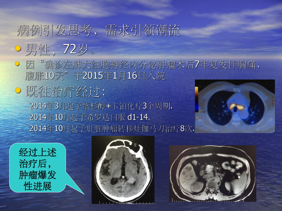 肺癌的免疫靶向治疗课件.ppt_第2页