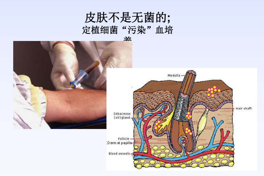 血培养的操作规范及临床意义课件.ppt_第2页