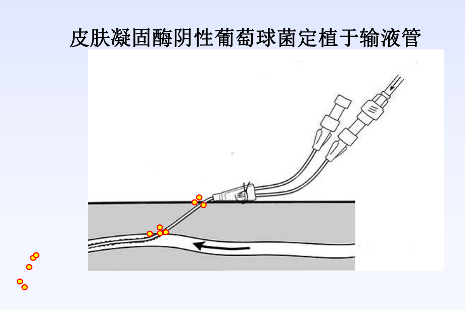 血培养的操作规范及临床意义课件.ppt_第3页