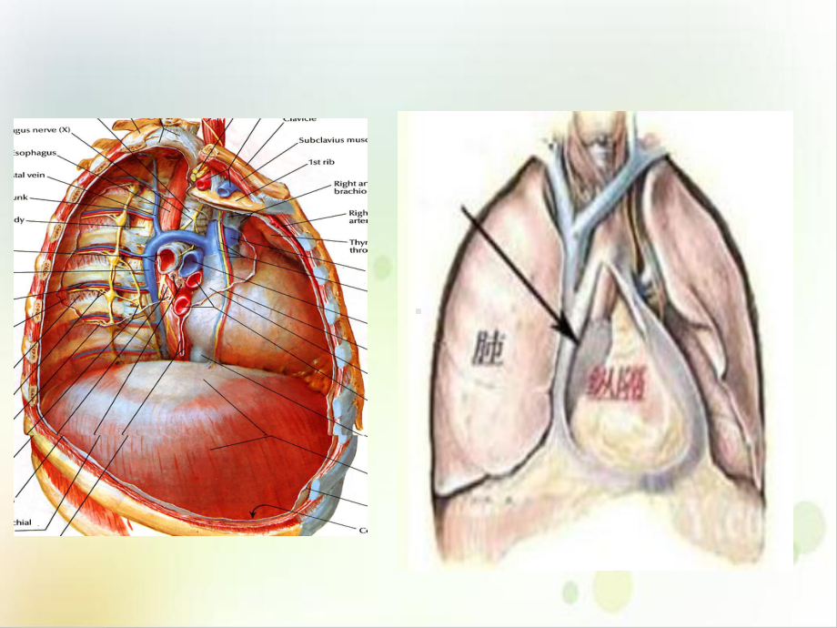 纵膈肿瘤术后病人查房培训课程课件.ppt_第3页